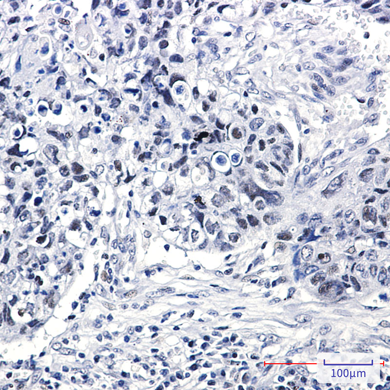 2 - hnRNP K Rabbit mAb AP75561