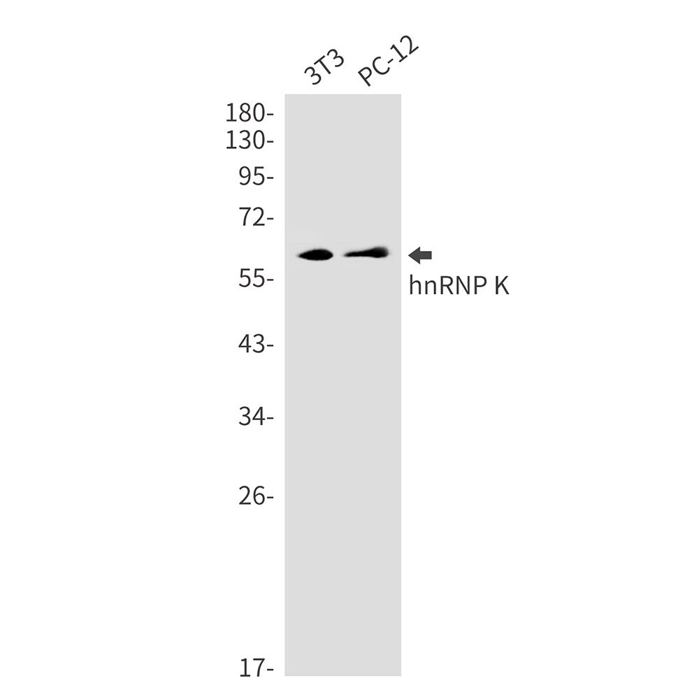 1 - hnRNP K Rabbit mAb AP75561