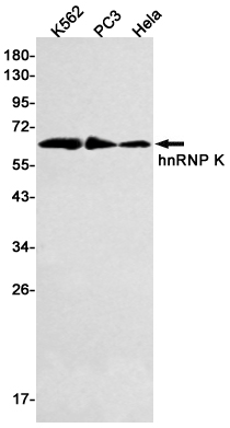 2 - hnRNP K Rabbit mAb AP75561
