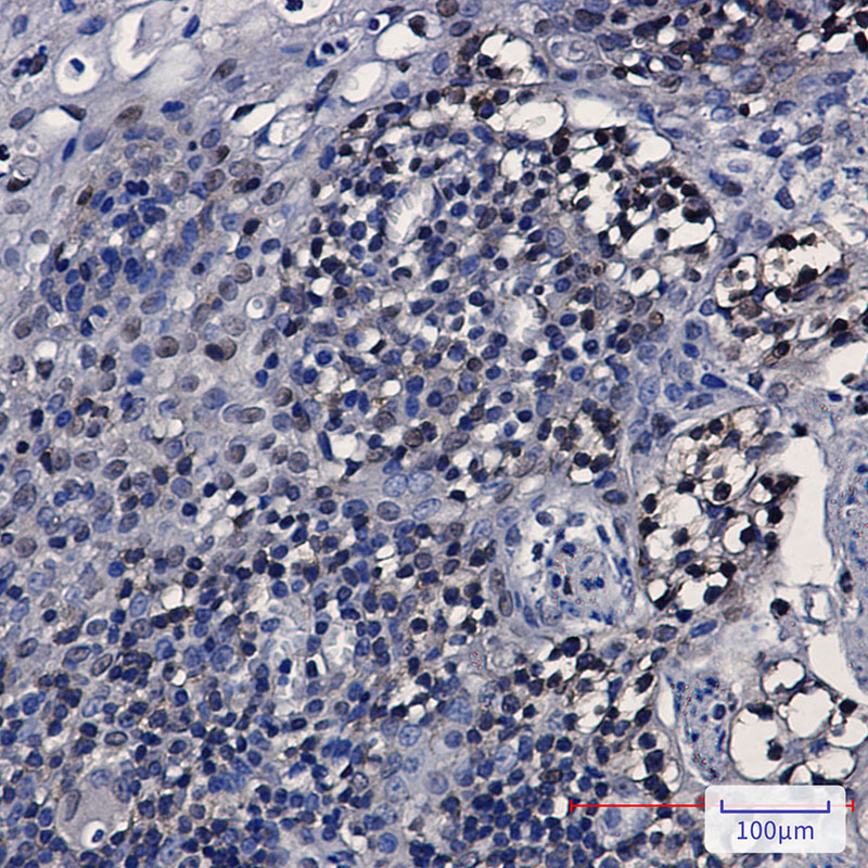 2 - hnRNP K Rabbit mAb AP75562