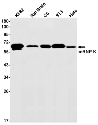 1 - hnRNP K Rabbit mAb AP75562
