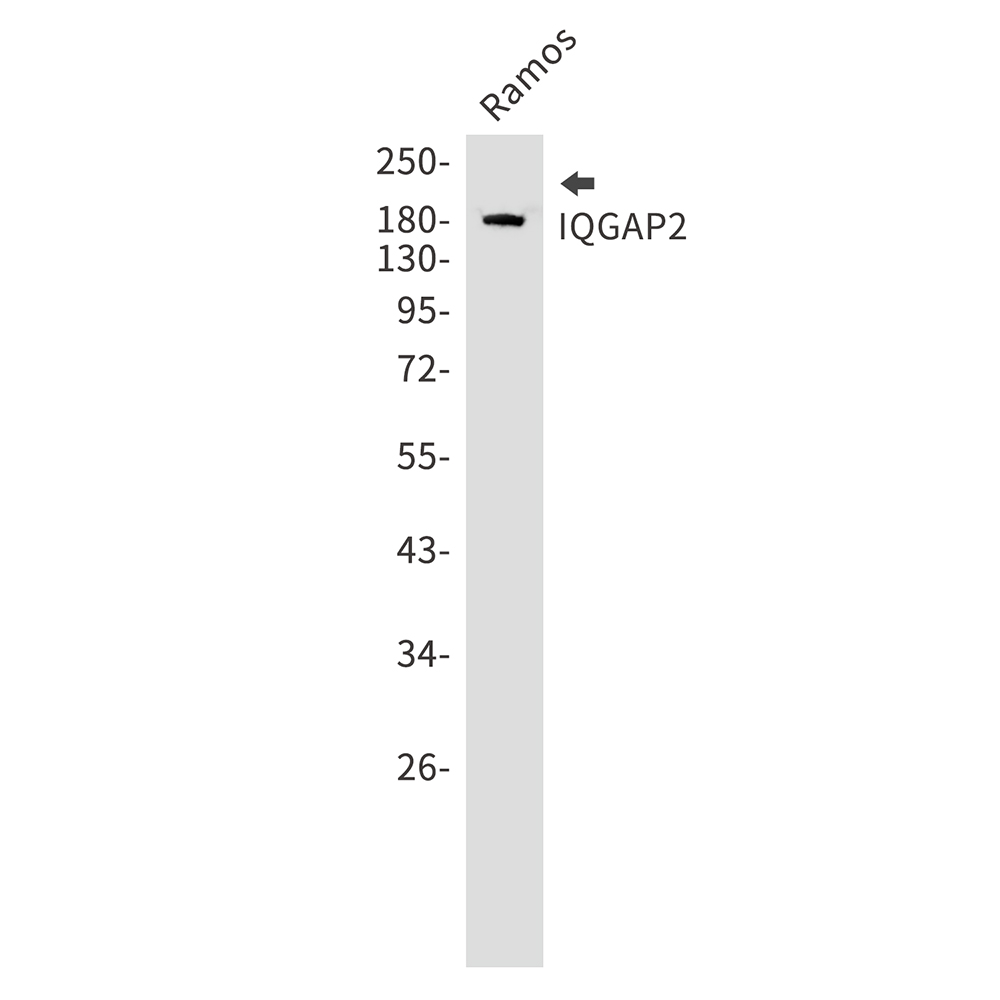 1 - IQGAP2 Rabbit mAb AP75628