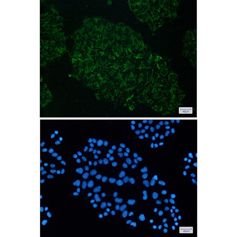 3 - ME2 Rabbit mAb AP75704