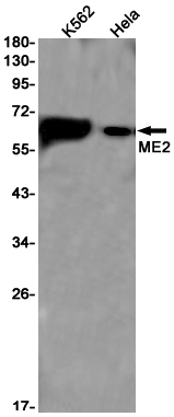 1 - ME2 Rabbit mAb AP75704