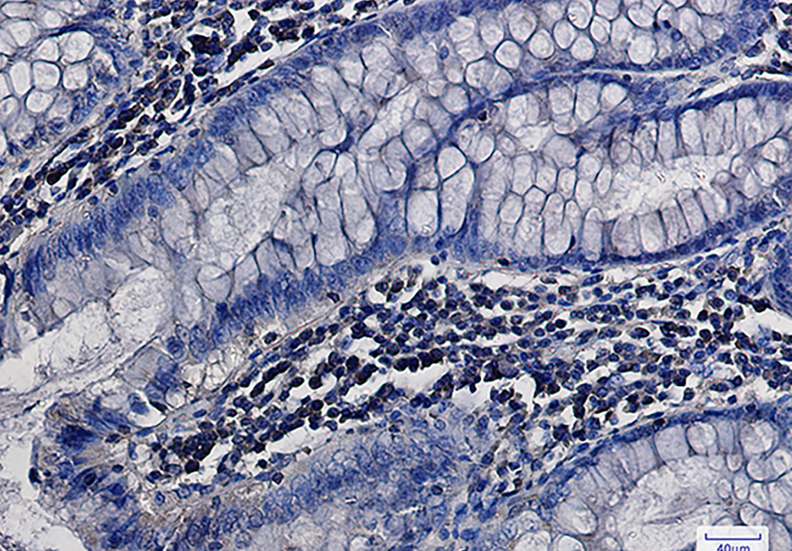 3 - MEK1/2 Rabbit mAb AP76867