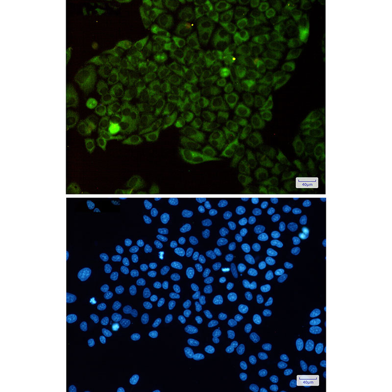 3 - MetRS Rabbit mAb AP75714