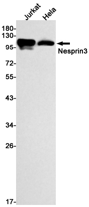 1 - Nesprin3 Rabbit mAb AP75798