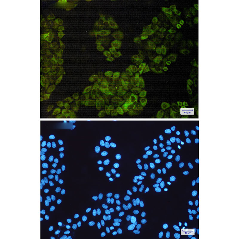 3 - NF-KB p100 Rabbit mAb AP75807