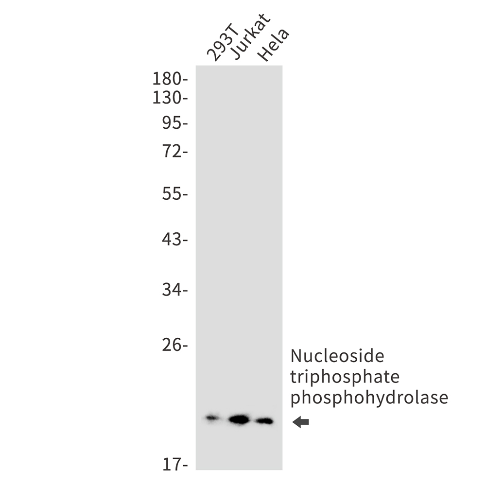 1 - NTPCR Rabbit mAb AP75828