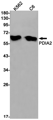 1 - P4HB Rabbit mAb AP75883