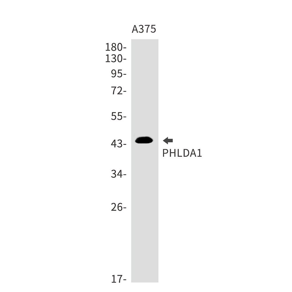 1 - PHLDA1 Rabbit mAb AP75905