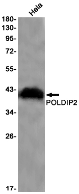 1 - POLDIP2 Rabbit mAb AP75931