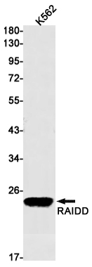 1 - RAIDD Rabbit mAb AP75998