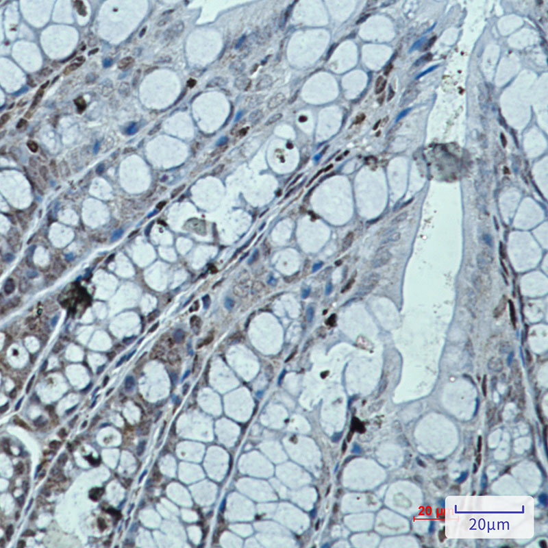 1 - RUNX Rabbit mAb AP76044