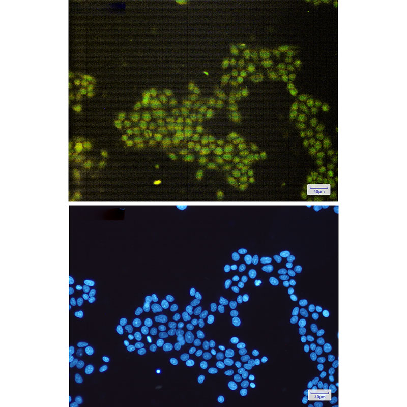 3 - SAE1 Rabbit mAb AP76049