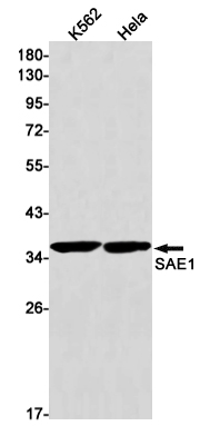 1 - SAE1 Rabbit mAb AP76049