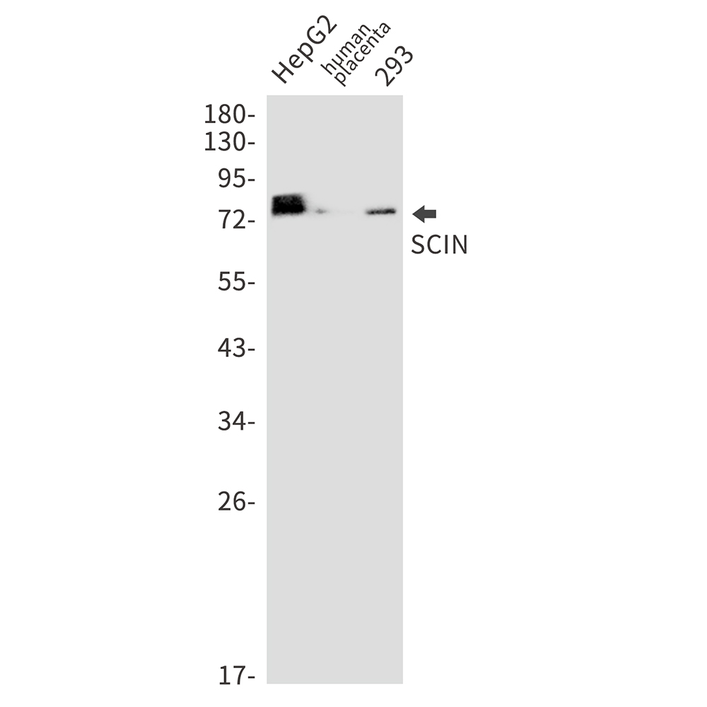1 - SCIN Rabbit mAb AP76061