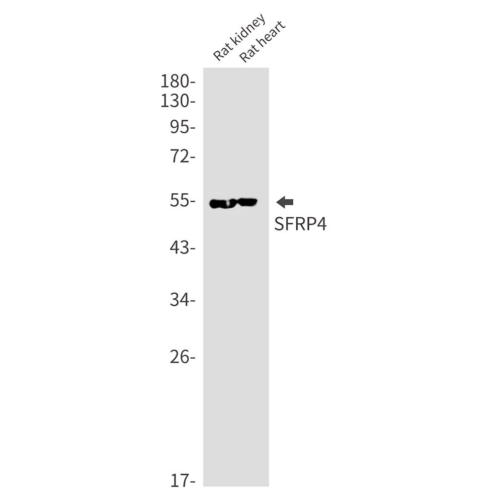 1 - SFRP4 Rabbit mAb AP76076