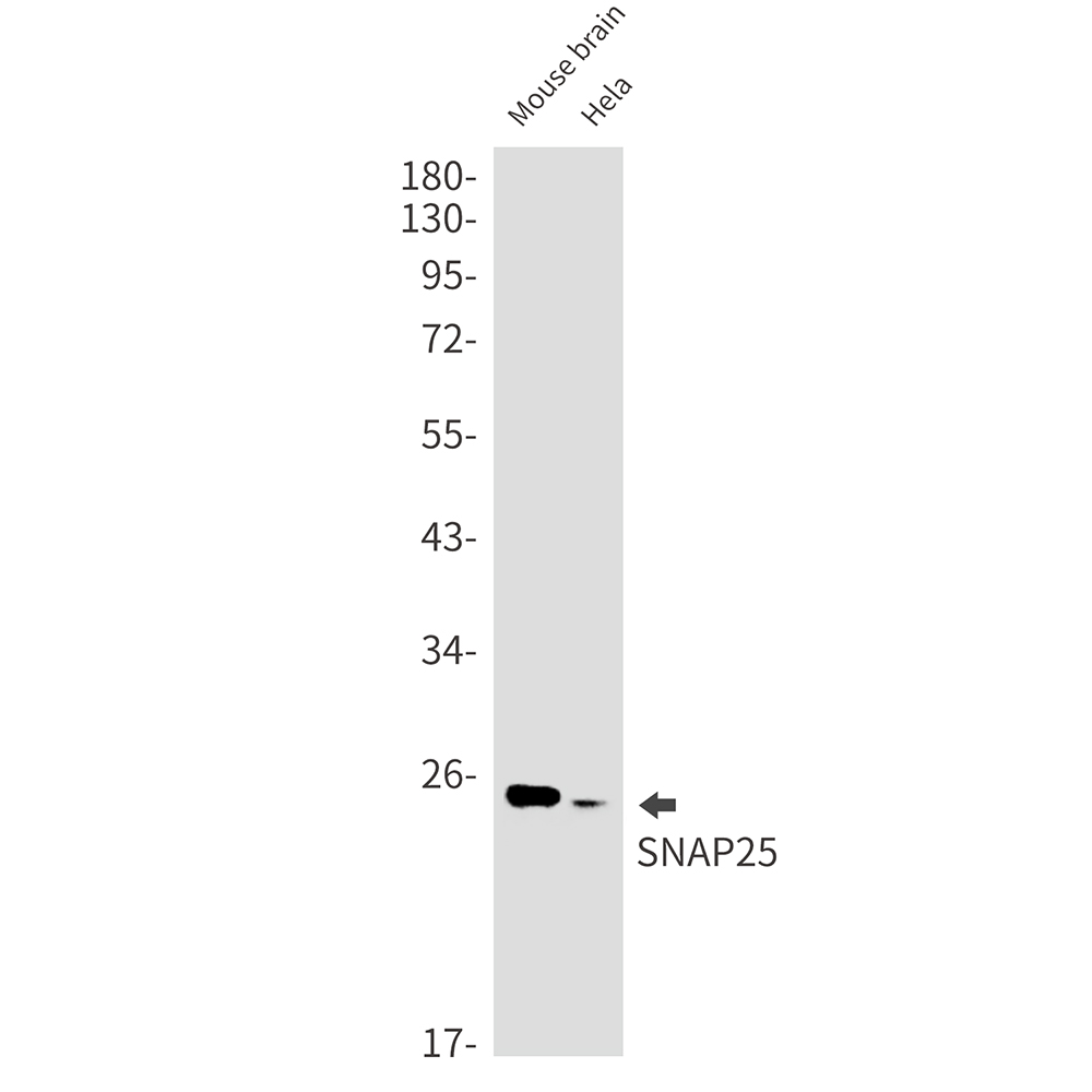 1 - SNAP25 Rabbit mAb AP76100