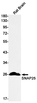 1 - SNAP25 Rabbit mAb AP76100
