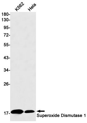 1 - Superoxide Dismutase 1 Rabbit mAb AP76135