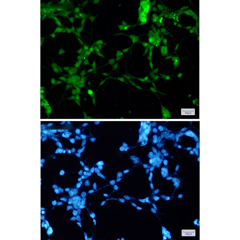 1 - TDP 43 Rabbit mAb AP76163