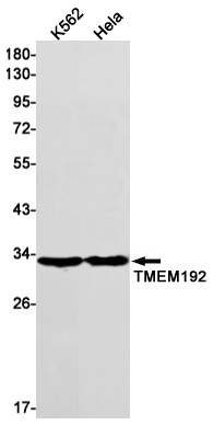 1 - Transmembrane Protein 192 Rabbit mAb AP76181