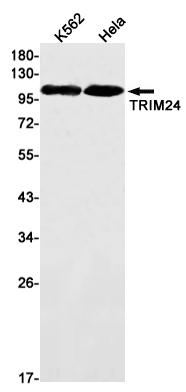 1 - TRIM24 Rabbit mAb AP76203