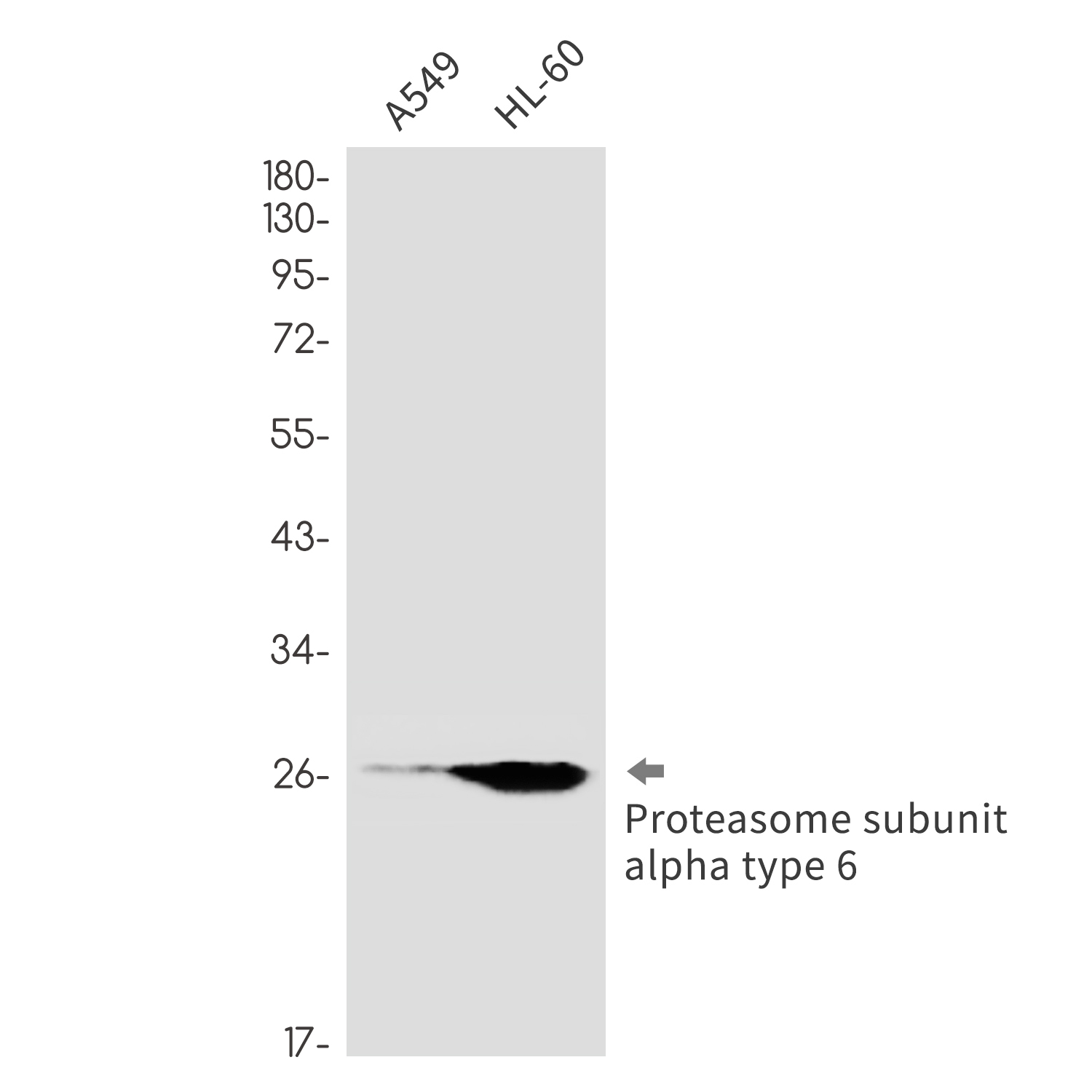1 - Proteasome alpha 6 Rabbit mAb AP76310
