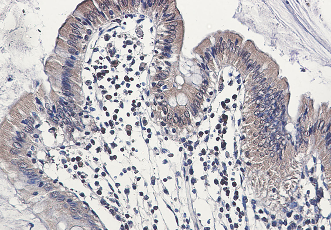 2 - Caspase 6 Rabbit mAb AP76421