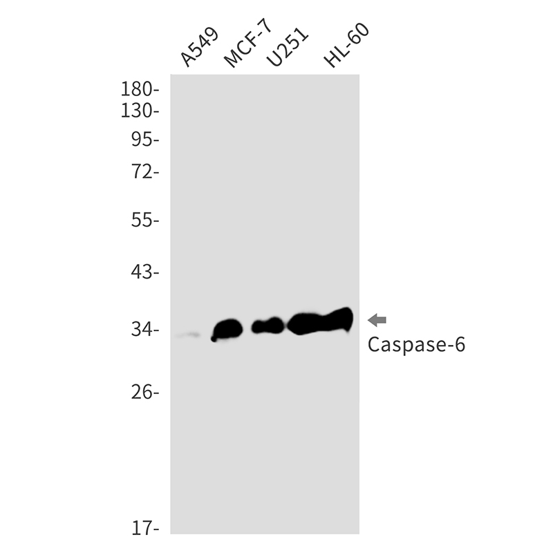 1 - Caspase 6 Rabbit mAb AP76421