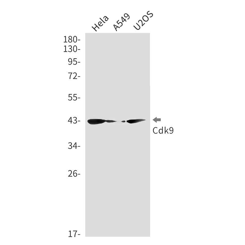 5 - CDK9 Rabbit mAb AP76436