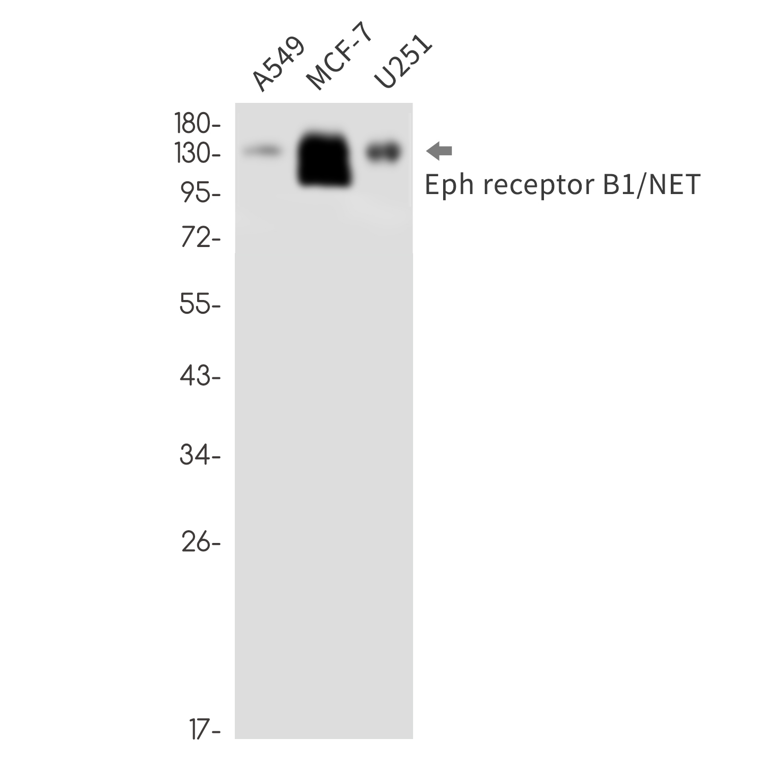 1 - Ephrin Receptor B1 Rabbit mAb AP76483
