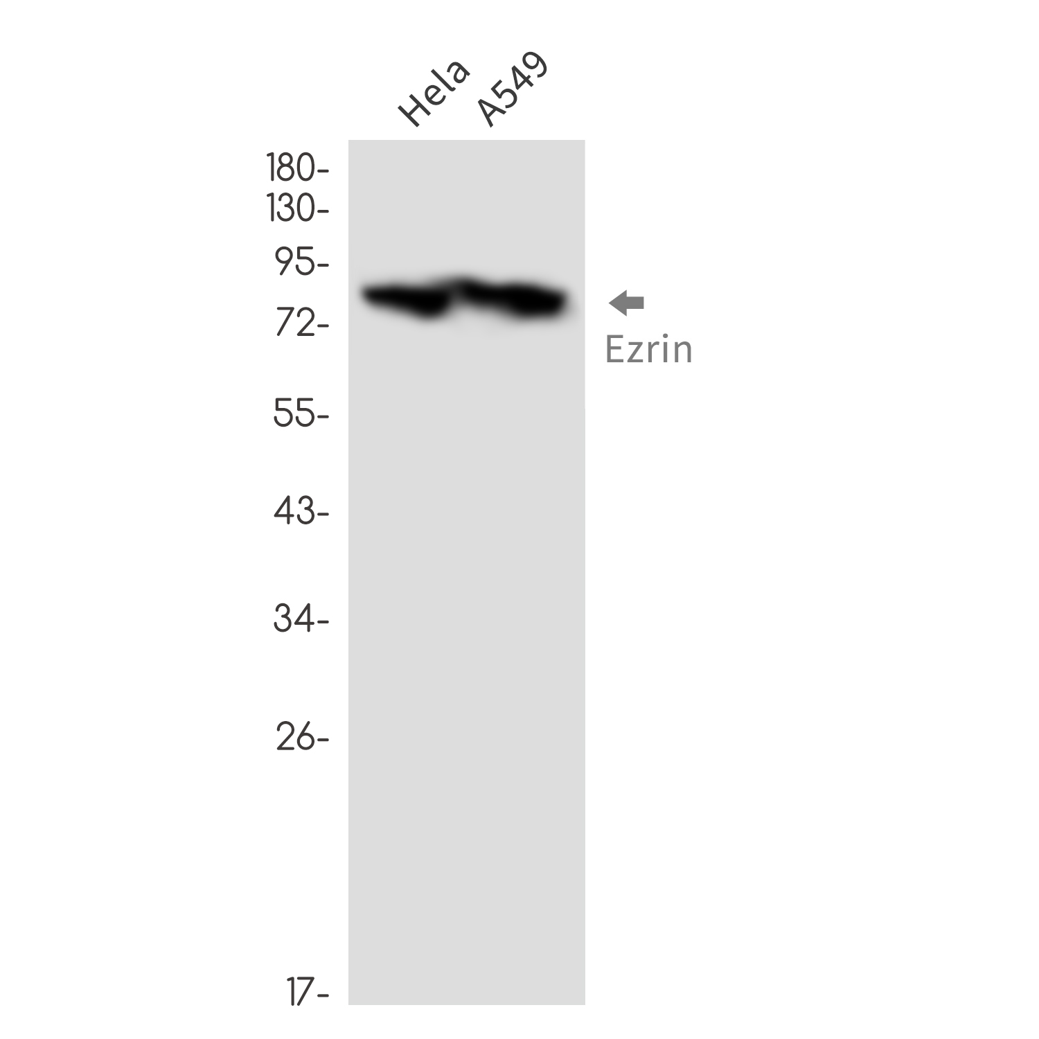 1 - Ezrin Rabbit mAb AP76491