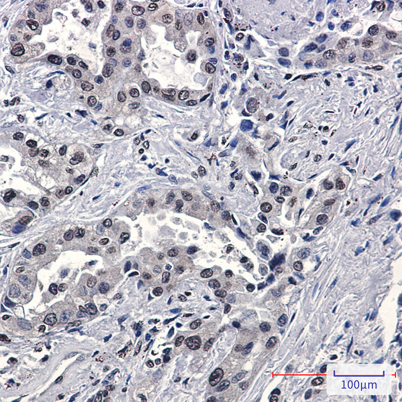 2 - FKBP52 Rabbit mAb AP76500
