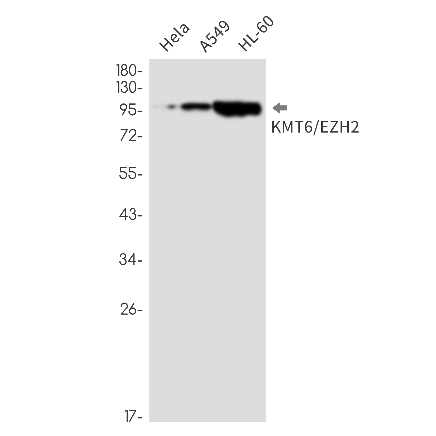 1 - KMT6 Rabbit mAb AP76562