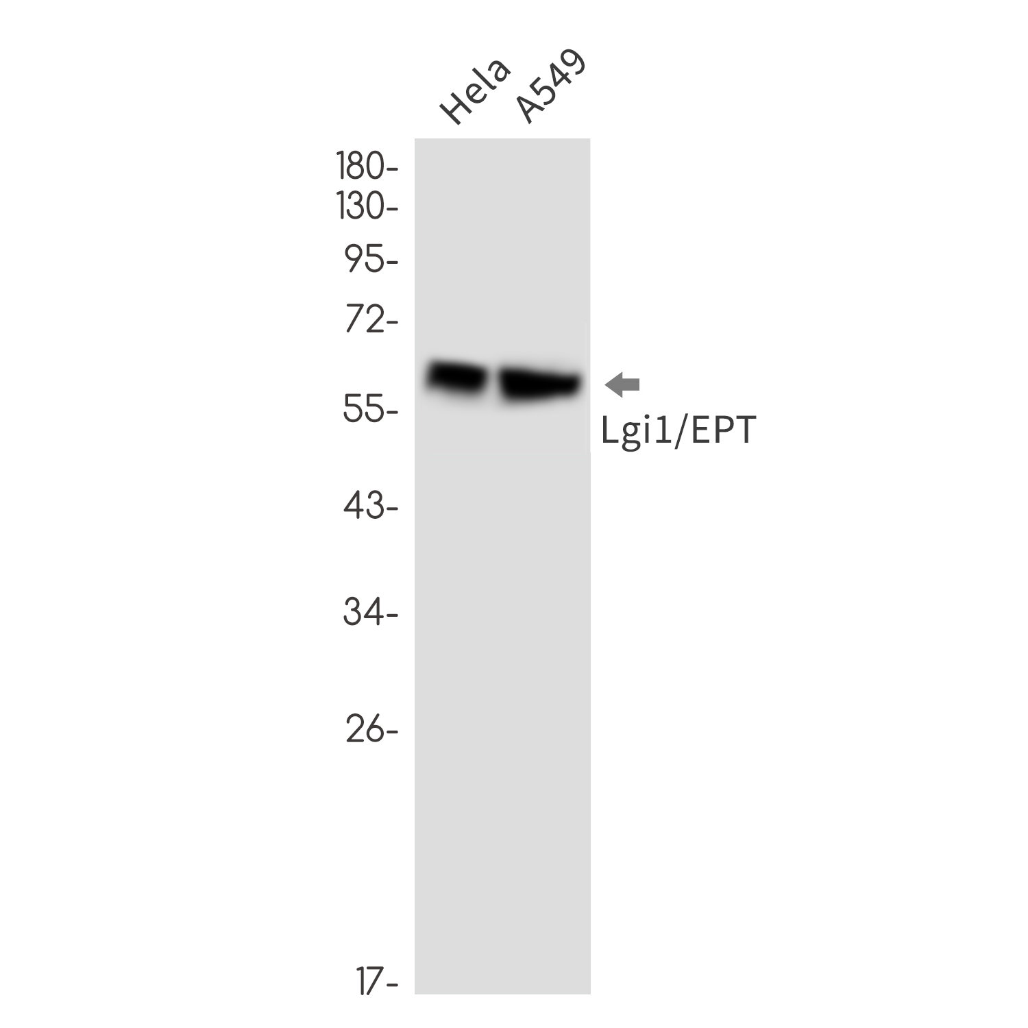 5 - LGI1 Rabbit mAb AP76567