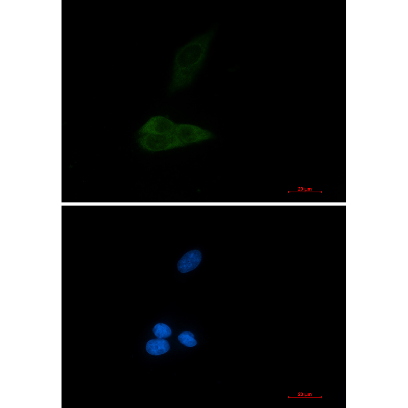 1 - MAP3K4 Rabbit mAb AP76579