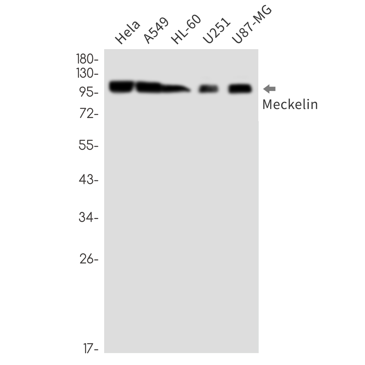 1 - Meckelin Rabbit mAb AP76585
