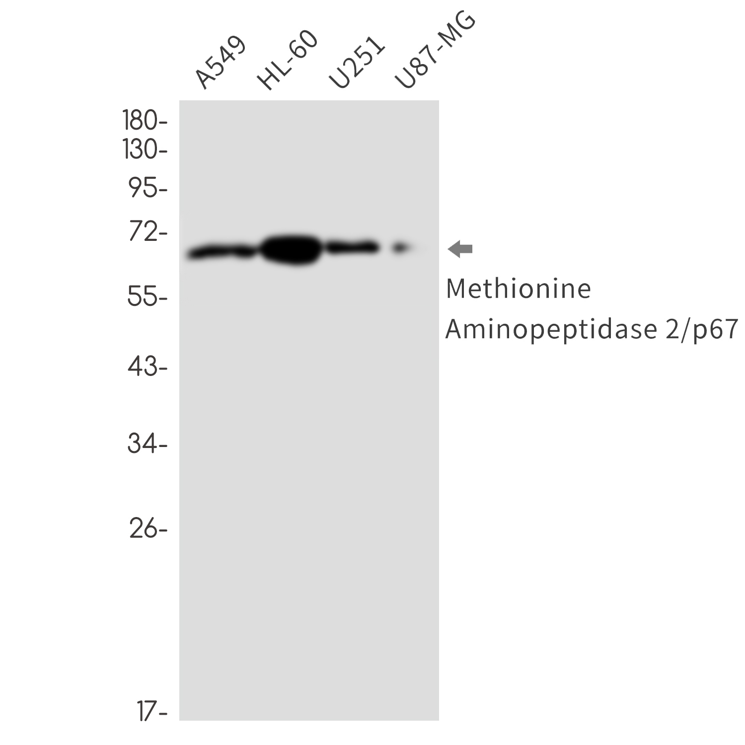 1 - Methionine Aminopeptidase 2 Rabbit mAb AP76589