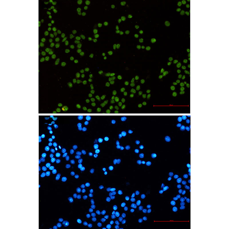 3 - MLH1 Rabbit mAb AP76594