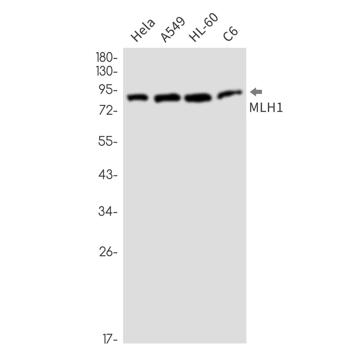1 - MLH1 Rabbit mAb AP76594