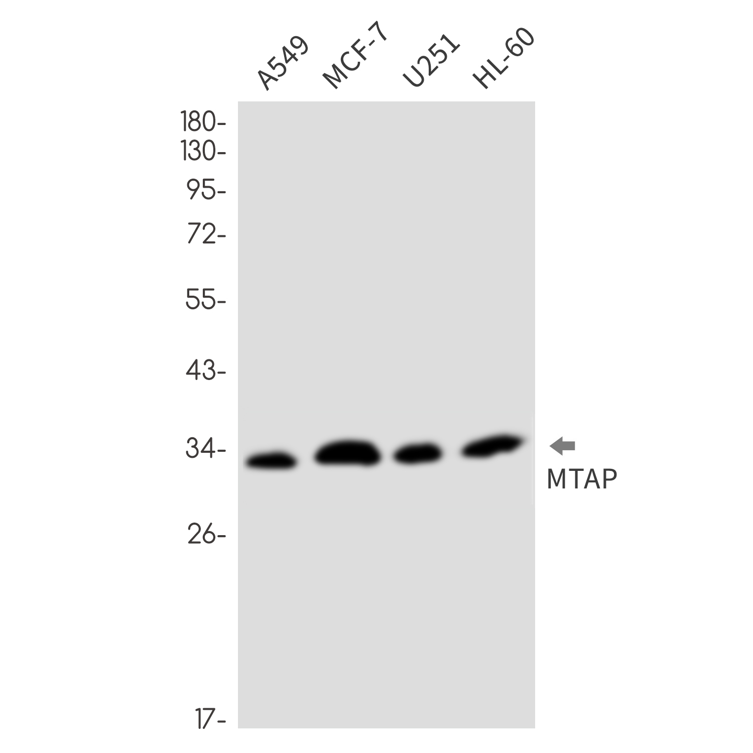 1 - MTAP Rabbit mAb AP76601