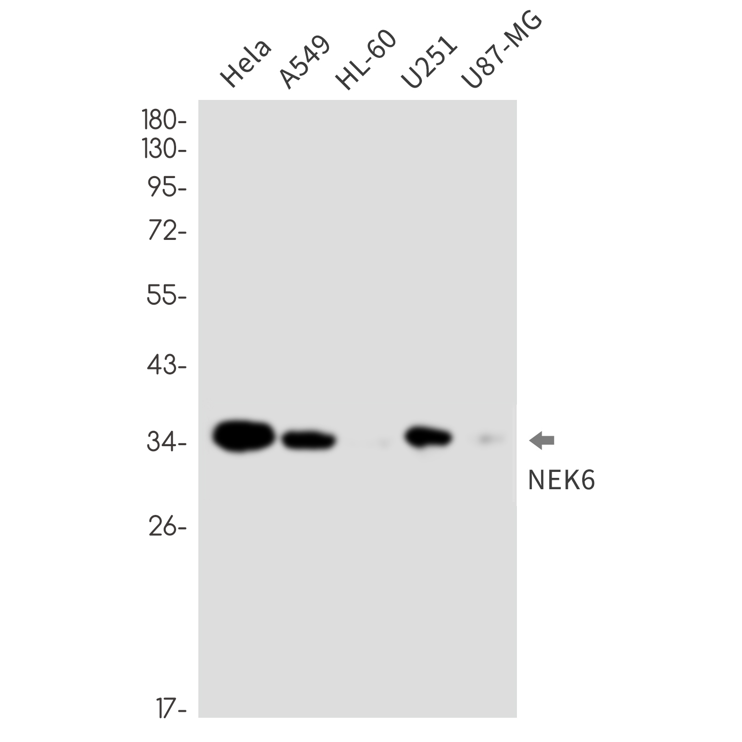 1 - NEK6 Rabbit mAb AP76613