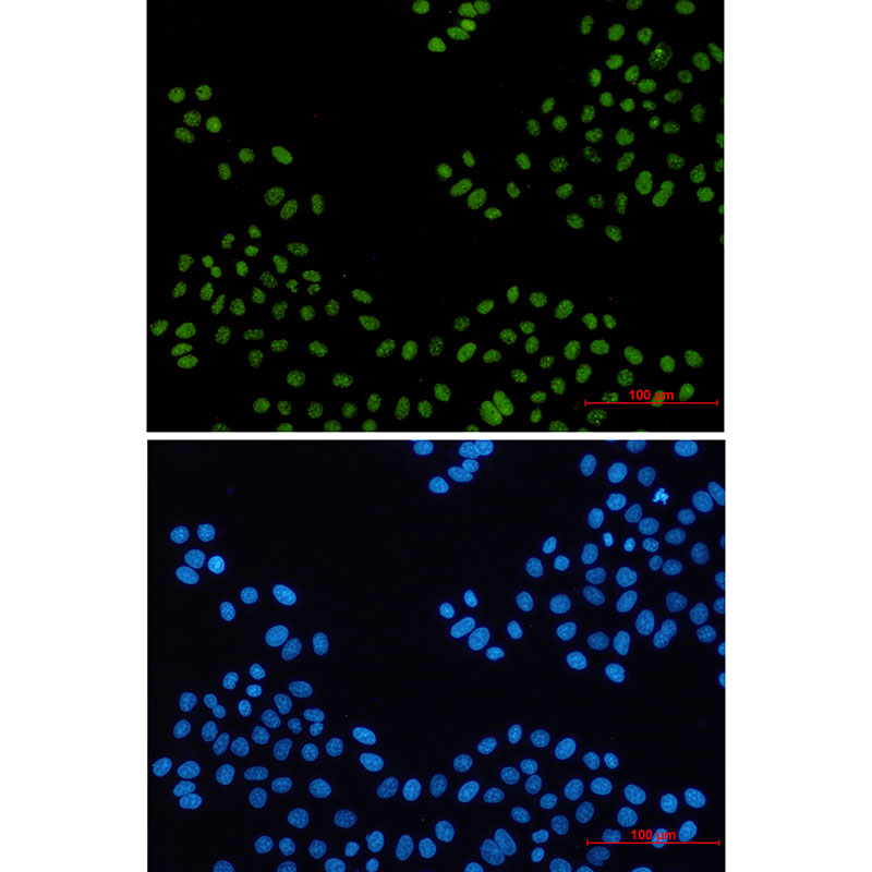 1 - PELP1 Rabbit mAb AP76646
