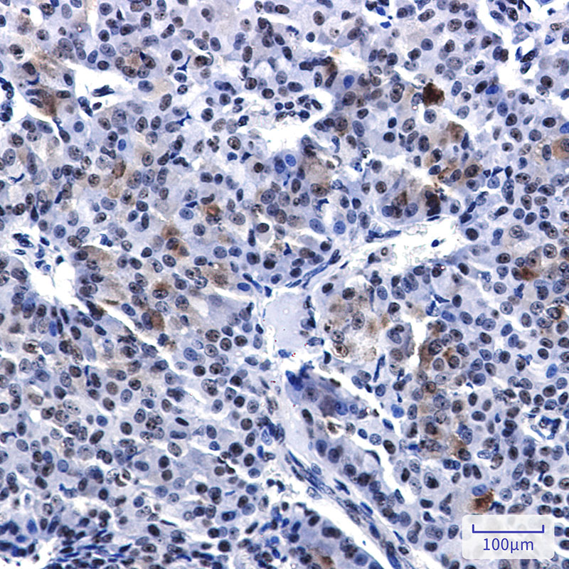 3 - PELP1 Rabbit mAb AP76646