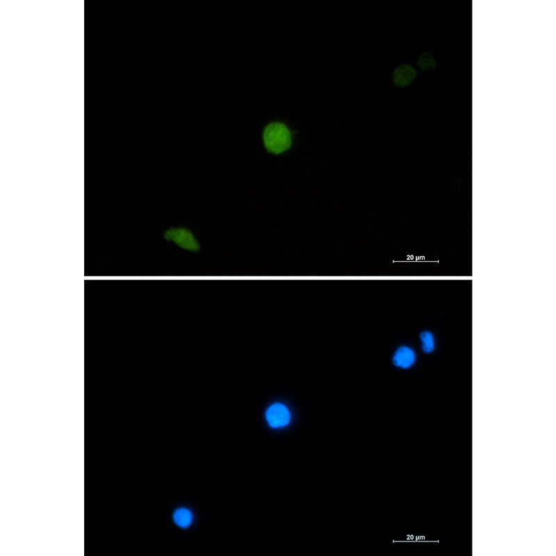1 - PELP1 Rabbit mAb AP76648