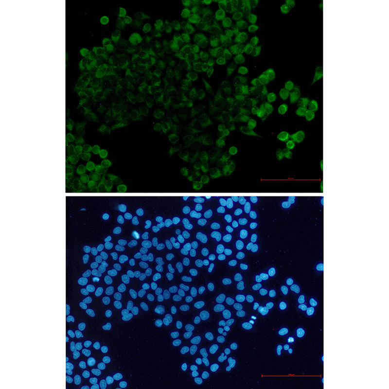 1 - PPP2R5E Rabbit mAb AP76668