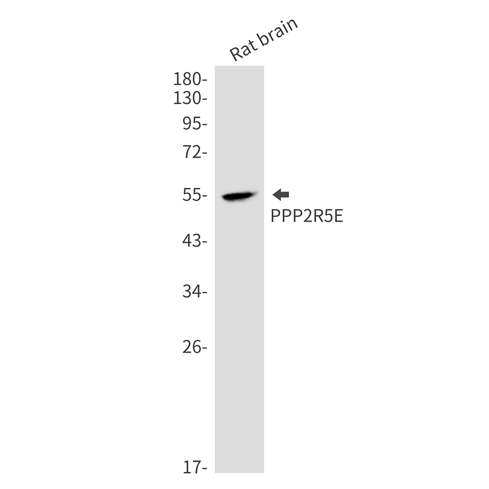 1 - PPP2R5E Rabbit mAb AP76668