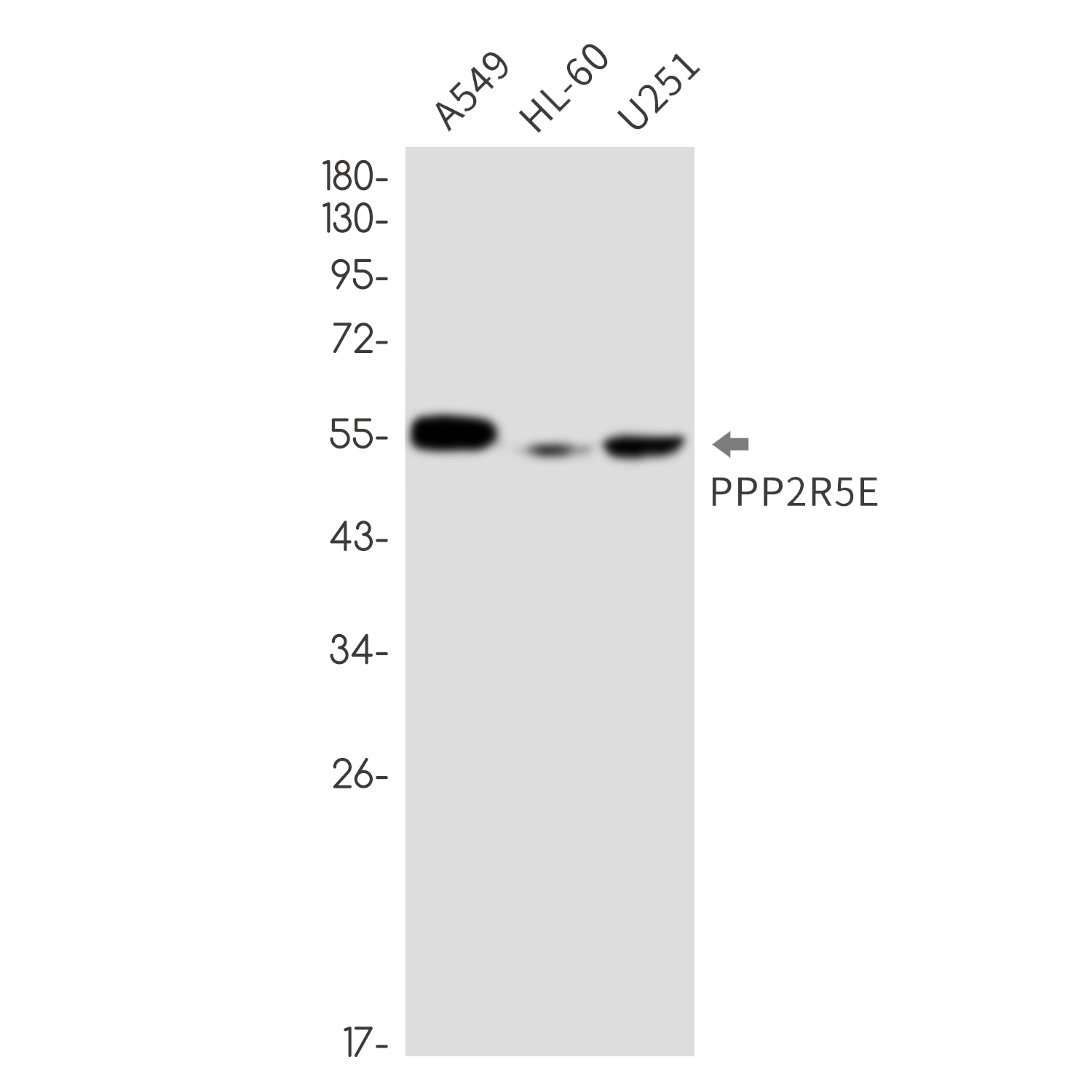 3 - PPP2R5E Rabbit mAb AP76668